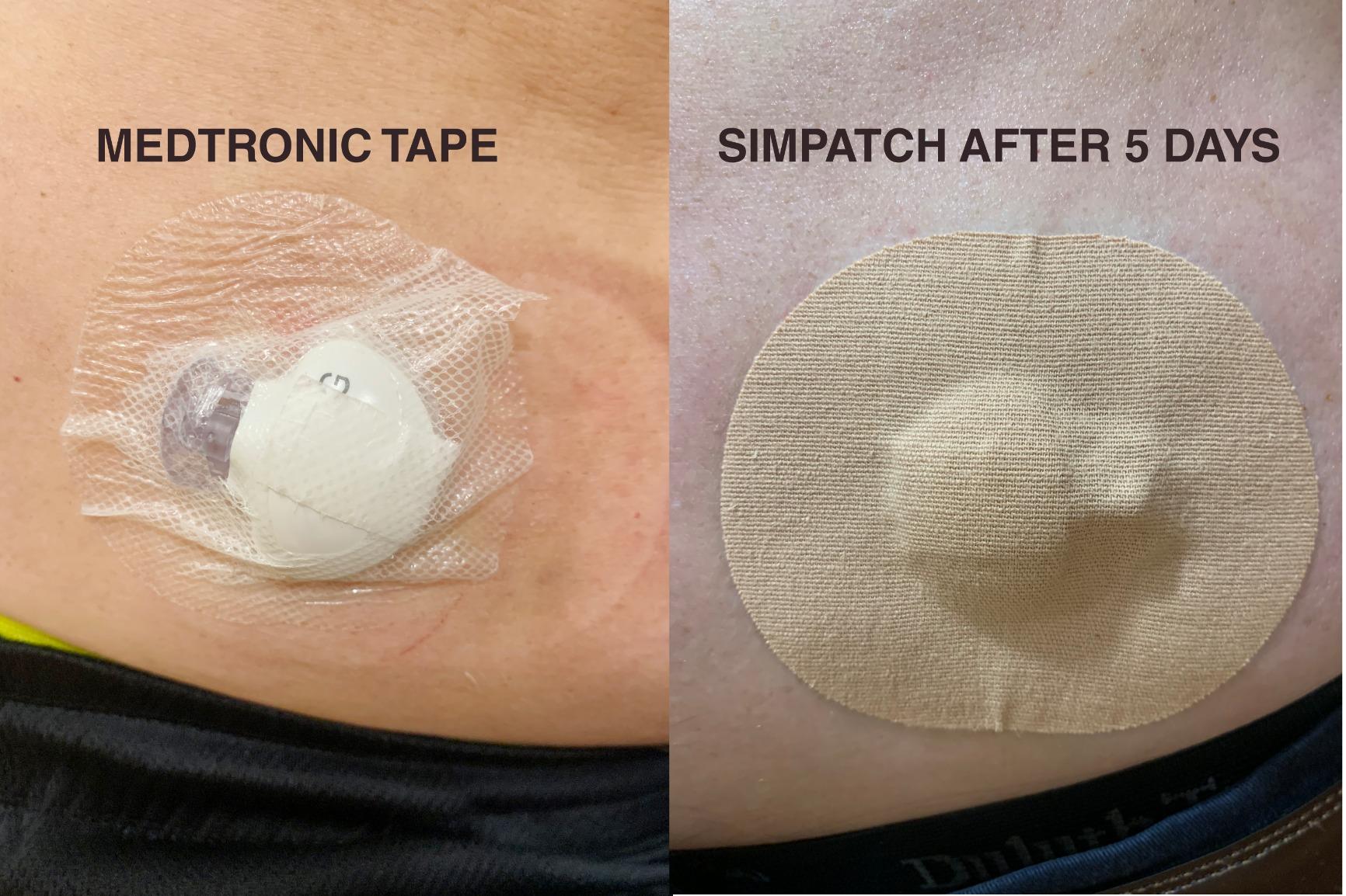 Skin-Tac Adhesive Barrier Wipes 50 Count customer photo 1