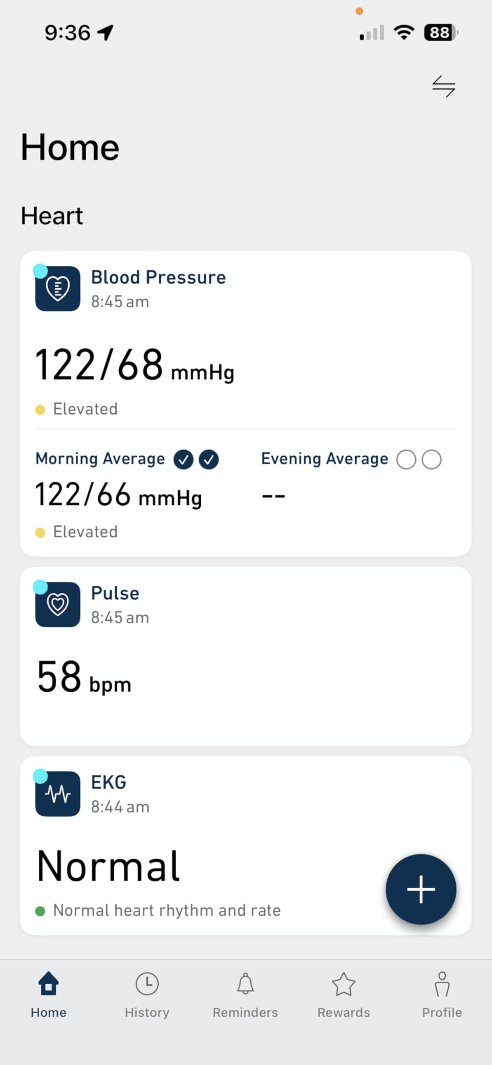 OMRON Complete 2-in-1 Blood Pressure Monitor + EKG for Home Use | Upper Arm Blood Pressure Cuff - #1 Doctor & Pharmacist Recommended Brand - Clinically Validated - Connect App customer photo 1