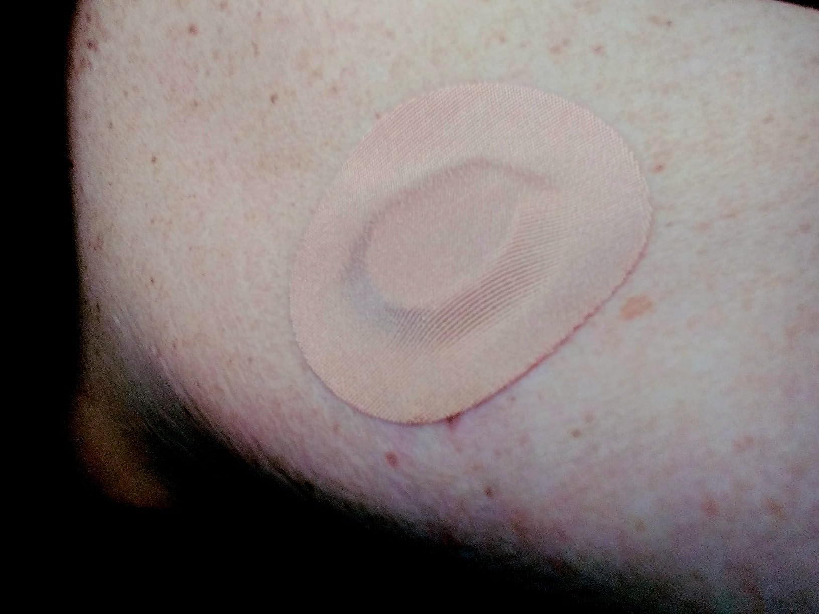 Skin Grip Freestyle Libre 2 Sensor Covers & Lingo CGM - 20 Pack | Waterproof & Sweatproof Patch, 15+ Days of Strong Grip customer photo 1