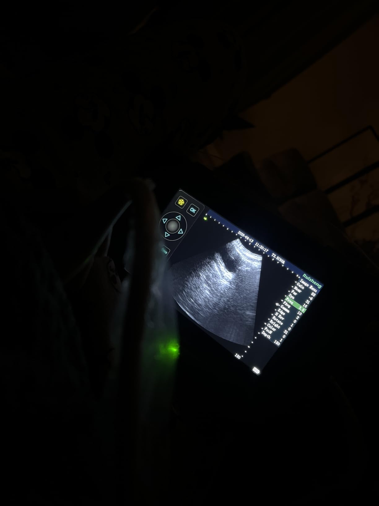 T1 Portable Veterinary Ultrasound Machine with 3.5 MHz Probe, 8