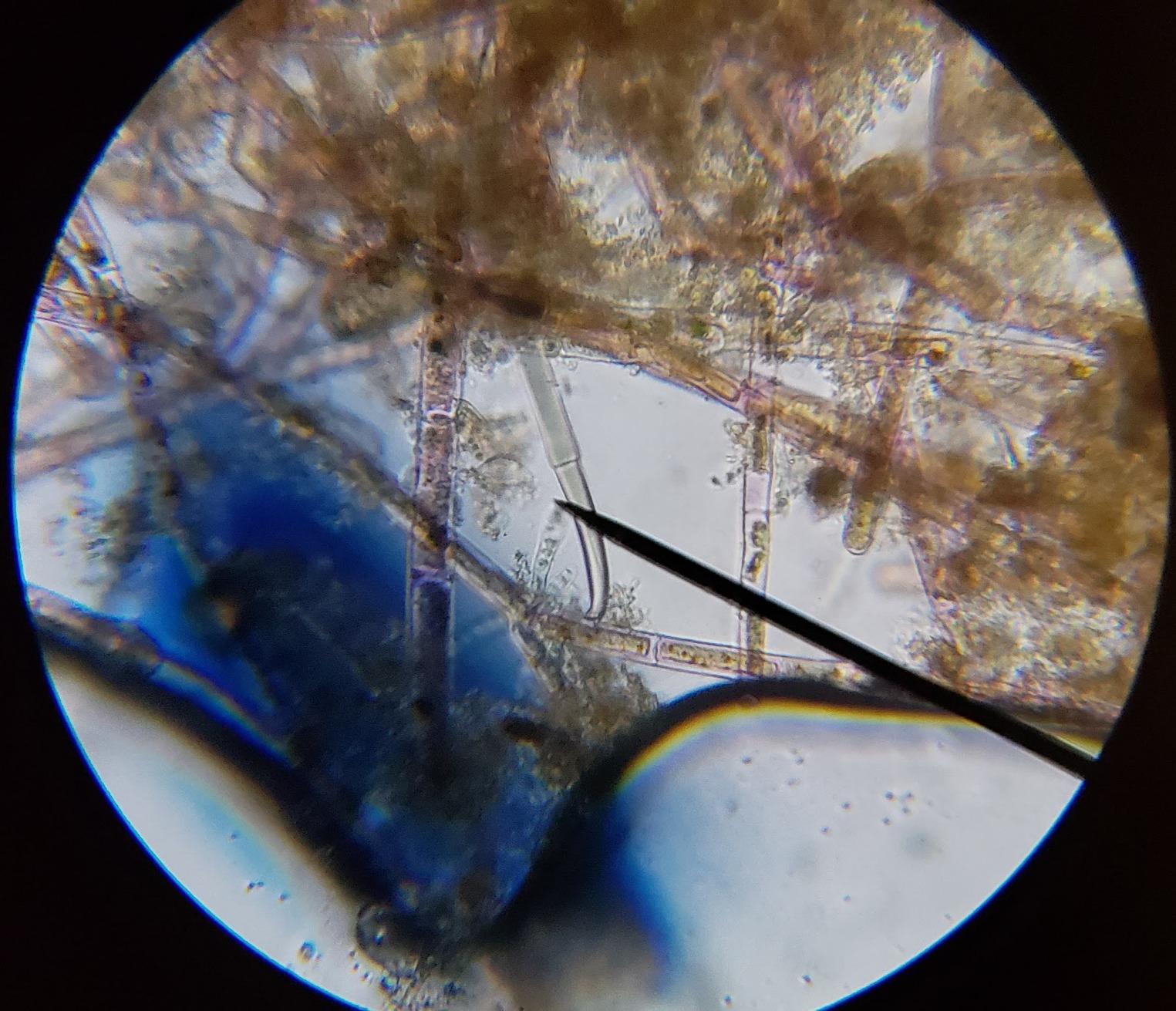 AmScope M150C 40X-1000X All-Metal Optical Glass Lenses Cordless LED Compound Biological Microscope customer photo 1