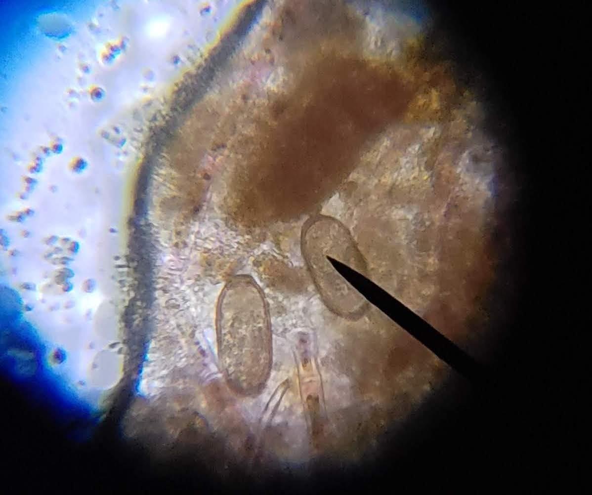 AmScope M150C 40X-1000X All-Metal Optical Glass Lenses Cordless LED Compound Biological Microscope customer photo 2